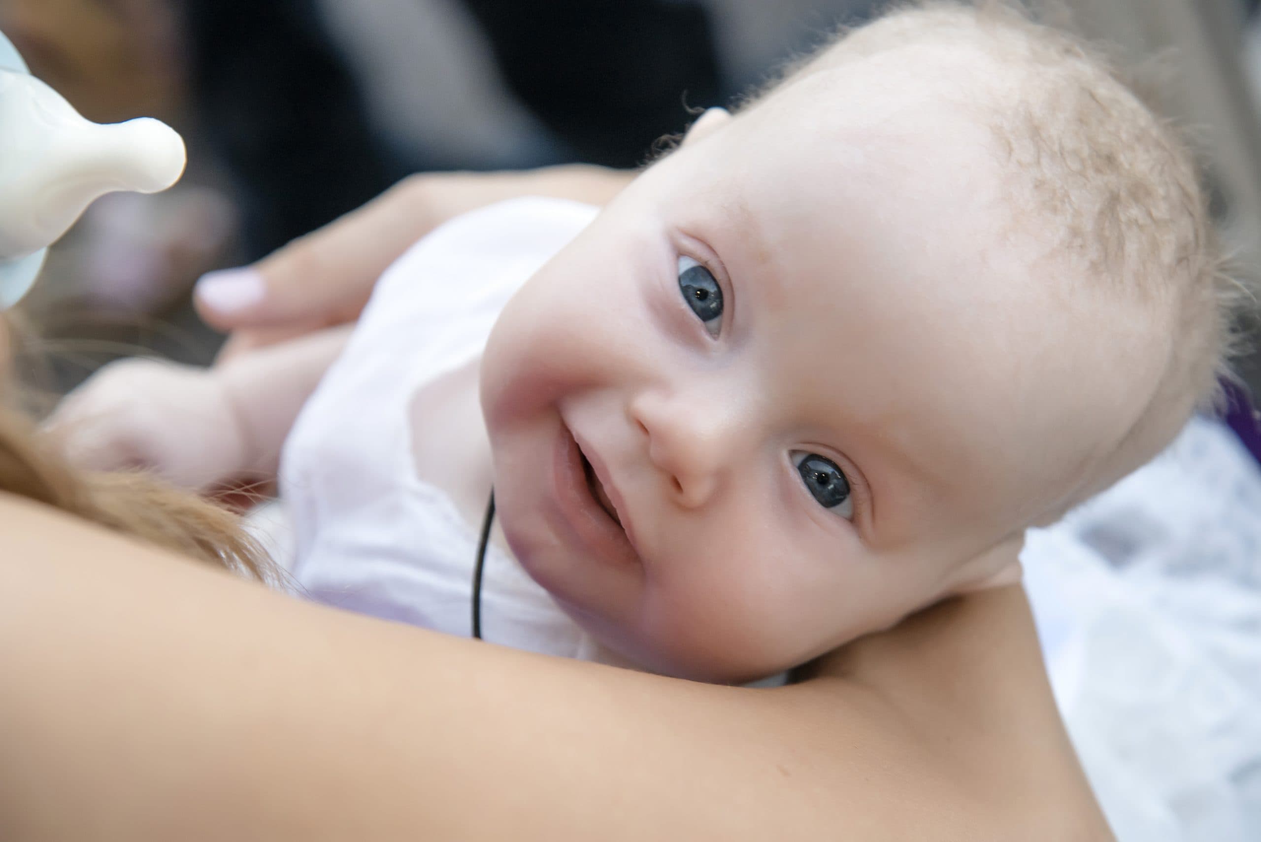 Marco — child with Menkes disease